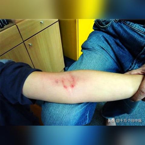 身体突发状况，腿部不适，百度来解答你的疑惑